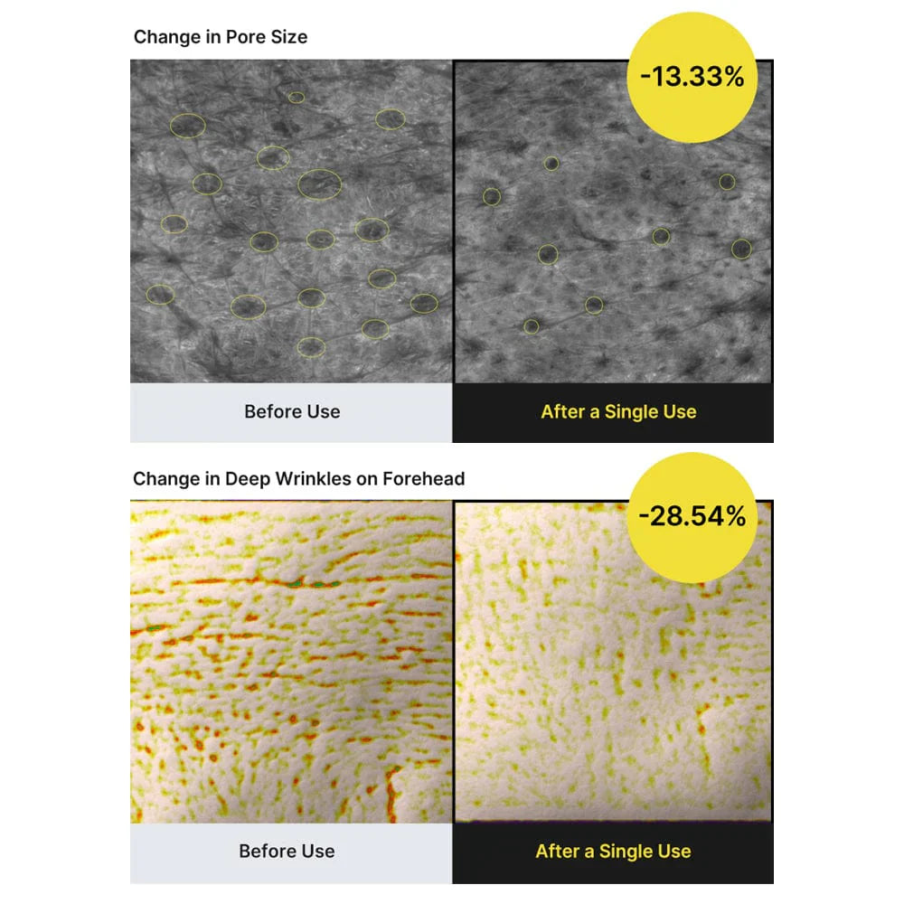 Retinal Shot Tightening Booster
