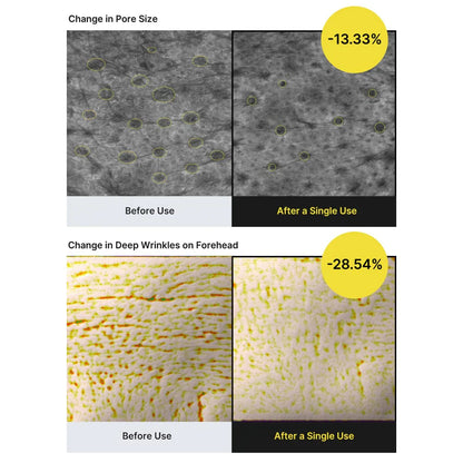 Retinal Shot Tightening Booster