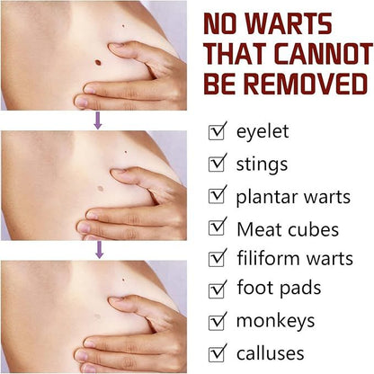 Fivfivgo™ WipeOff Tags & Mole Remover