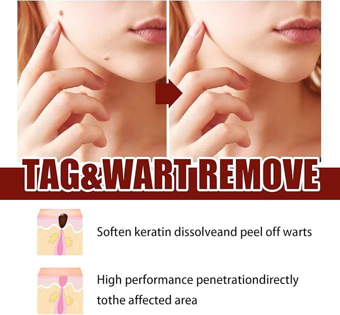 Fivfivgo™ WipeOff Tags & Mole Remover