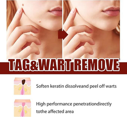 Fivfivgo™ WipeOff Tags & Mole Remover